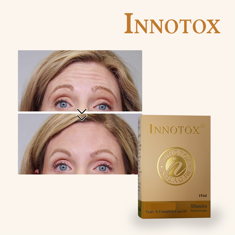 Innotox 50ui for Sale Toxina Botulinica