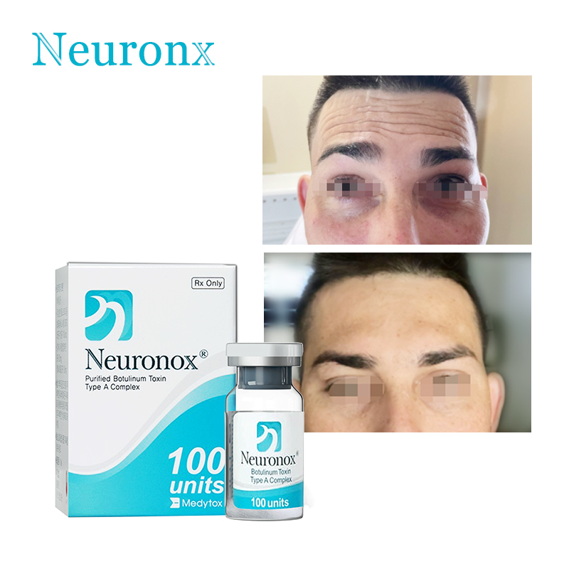  What is Korean Botox?
