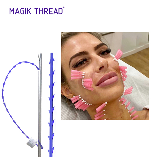 Nose Lift Thread