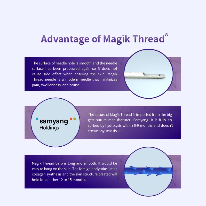 Barbed And Smooth Of Pdo Threads - Dermax