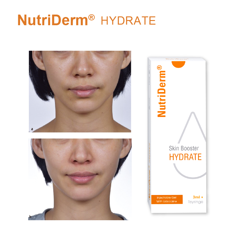Mesotherapy Price