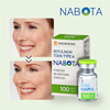 botulinum toxin type
