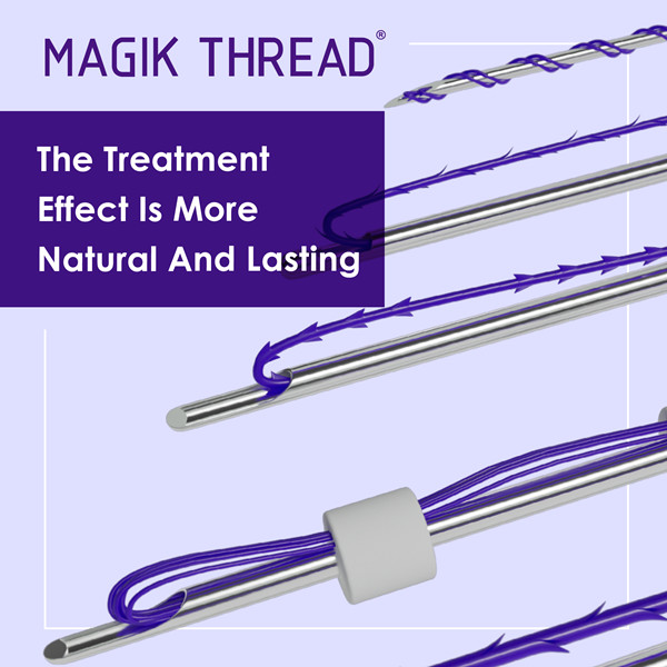 Which type of thread lift is best for You?